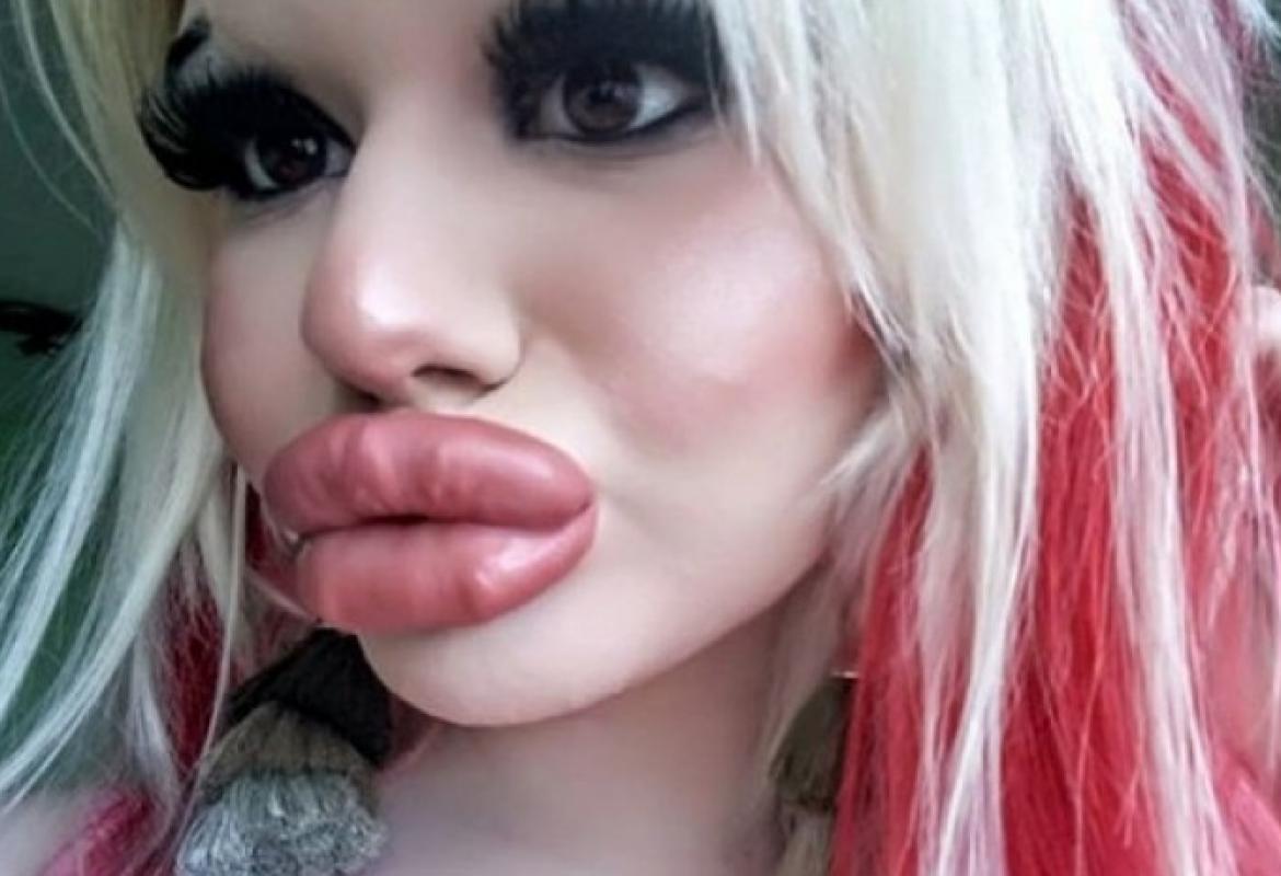 Lesbians With Big Lips