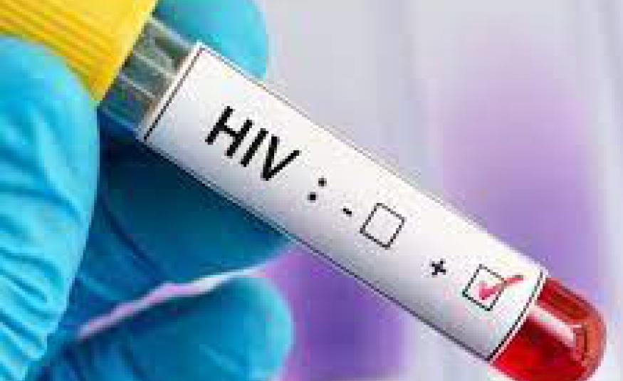 HIV